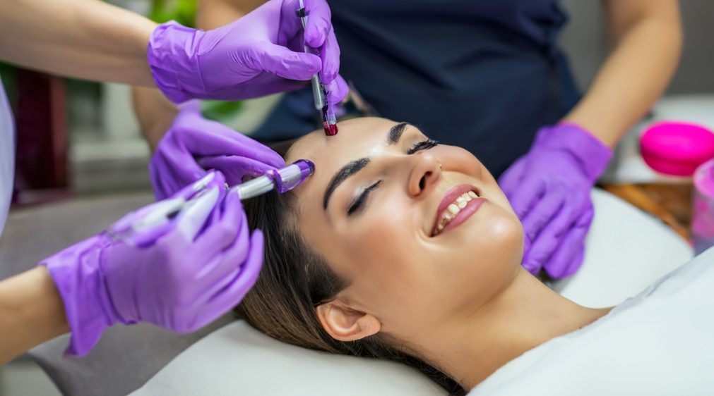 Microneedling Behandlung bei AMF Aesthetic Medical Fusion in Reutlingen