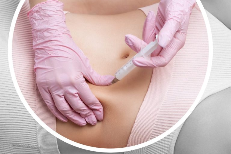 Fettwegspritze Behandlung bei AMF Aesthetic Medical Fusion in Reutlingen