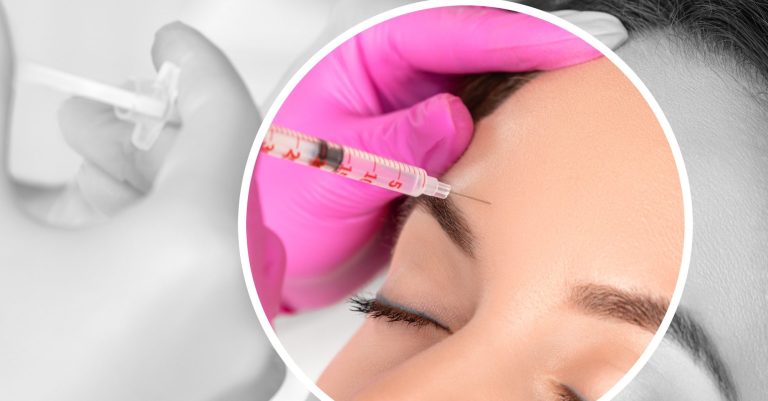 BioBotox Behandlung bei AMF Aesthetic Medical Fusion in Reutlingen