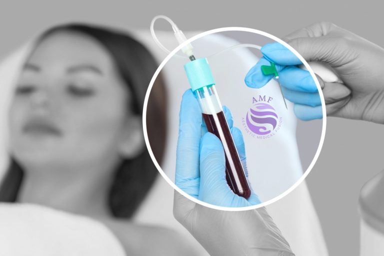 PRP D4 Behandlung bei AMF Aesthetic Medical Fusion in Reutlingen